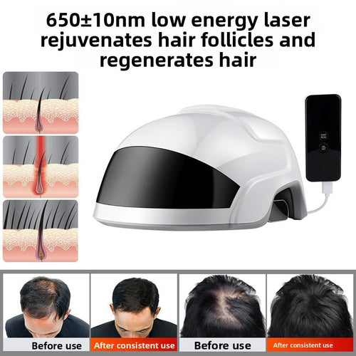 Lescolton Laser Hair Growth Helmet